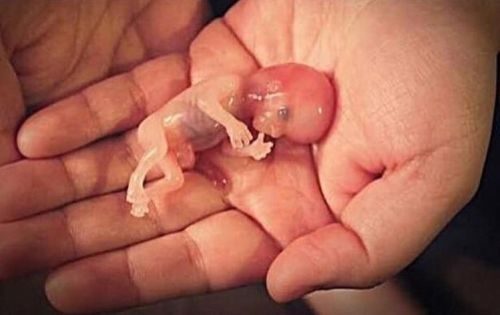 Семинар 'Аборты, выкидыши, мертворождения - исправление последствий' (Светлана Соколова)