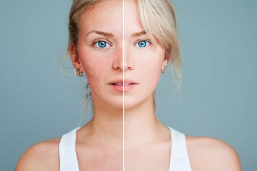 Чувствительная кожа: кто виноват и что делать? (Тийна Орасмяэ-Медер)