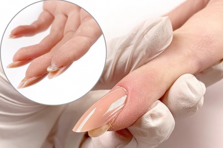 Исправление вниз растущего ногтя с помощью верхних форм (Яна Лузан)