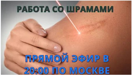 Работа со шрамами (Роман Воронцов)