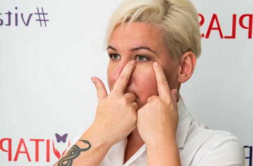 Витапластика для глаз (Надежда Басюбина)