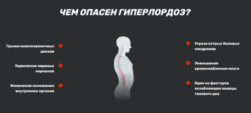 [FiveX] Здоровая спина при гиперлордозе ( Оля Лебедева, Елена Ломкина)