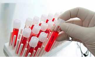 [IQketo] Анализы. Оптимальные значения (Анна Шутова)