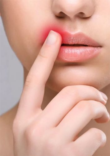 [Первая Школа Биохакинга] Герпес (Ирина Баранова)