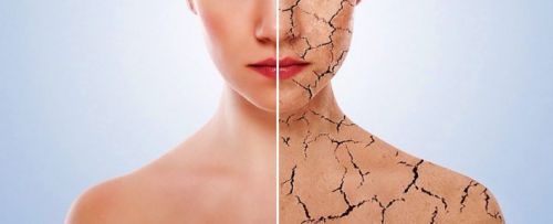 [Первая школа биохакинга] Псориаз (Ирина Баранова)