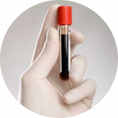 Антитела SARS-CoV-2 Covid-19 IgG