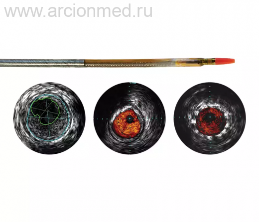 Цифровой катетер для ВСУЗИ Philips Reconnaissance PV .018 OTW