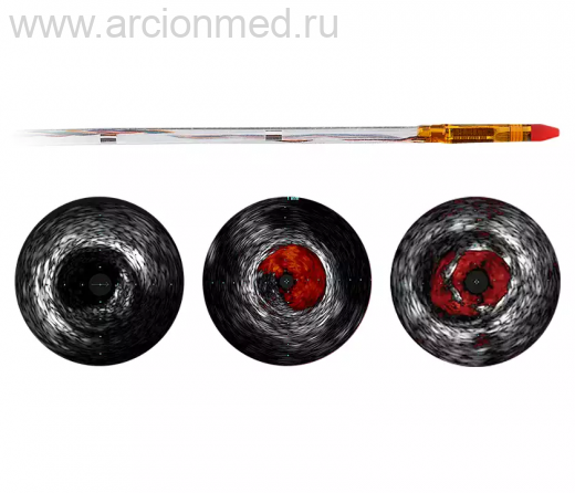 Цифровой катетер для ВСУЗИ Philips Eagle Eye Platinum ST Катетер с коротким кончиком