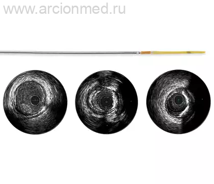 Refinity Ротационный катетер для внутрисосудистых ультразвуковых исследований