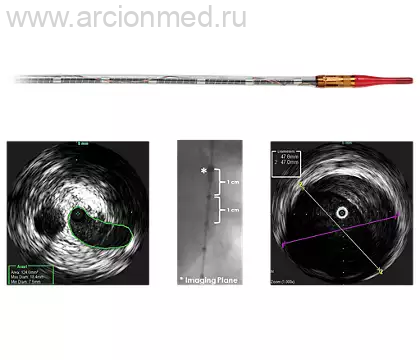 Visions PV (0,035 дюйма) Цифровой катетер для ВСУЗИ